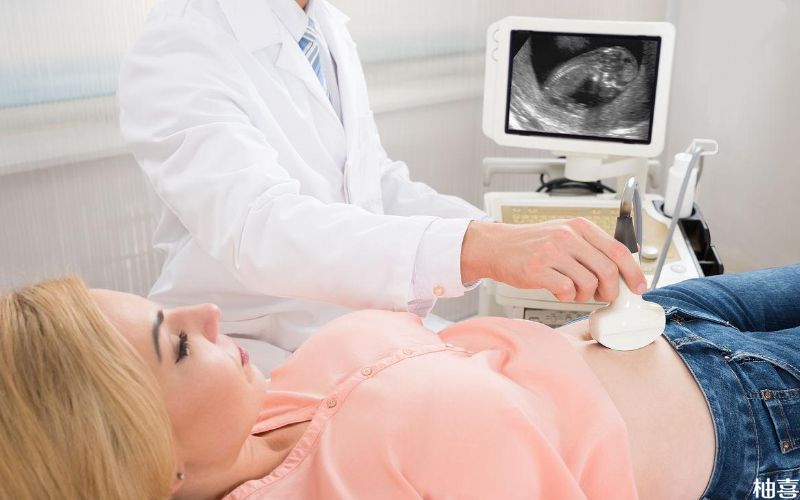 B超检查可以检测怀孕结果