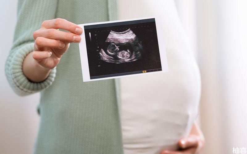 胎儿染色体异常要终止妊娠