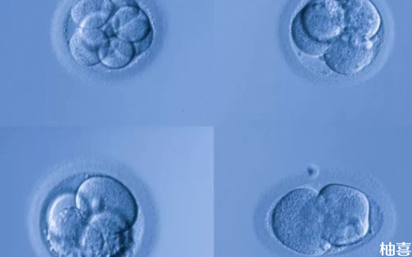 北京协和医院移植胚胎会卵巢扭转吗？