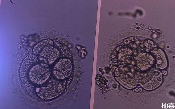 上海中山医院试管移植一个囊胚生双胞胎成功率多少？