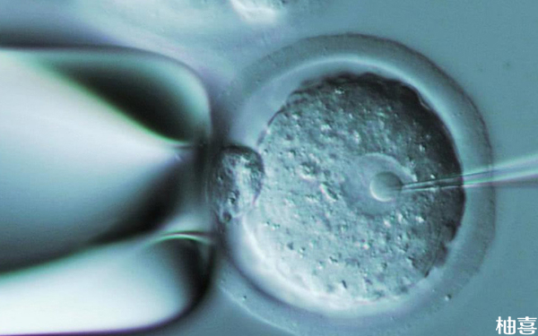 重庆妇幼生殖科取卵手术费用包含鲜囊胚移植吗？