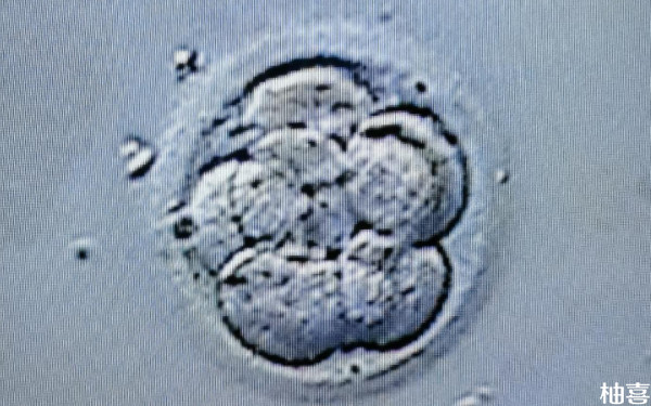 2024涿州市医院移植鲜胚是免费的吗？