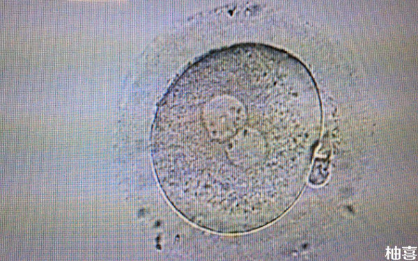 涿州市医院胚胎培养只有一枚多少钱？