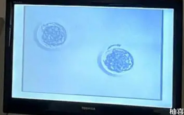 长治和平医院移植囊胚当天出院吗？