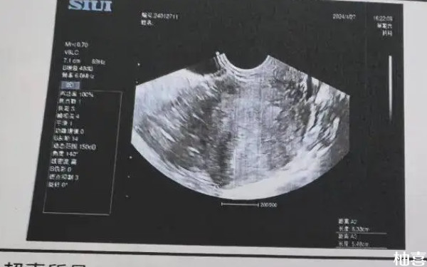 赤峰市妇产医院胚胎培养需要什么资料？
