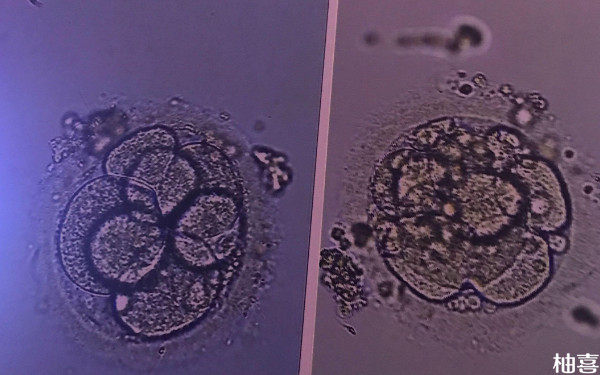 盛京医院移植d3鲜胚是即时移植吗？