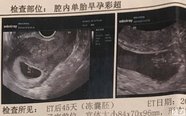 盛京医院囊胚移植是哪个生殖科医生？