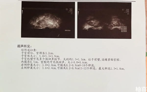 赤峰市妇产医院做二代供精试管需要做哪些检查？