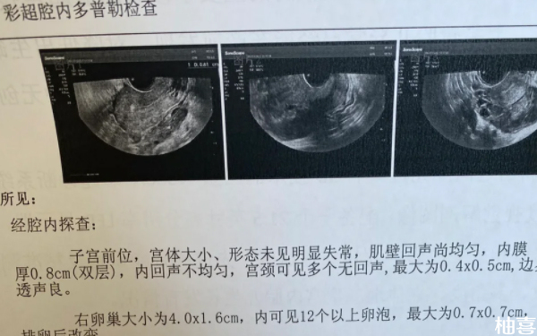 赤峰市妇产医院移植鲜囊胚要多久出结果？