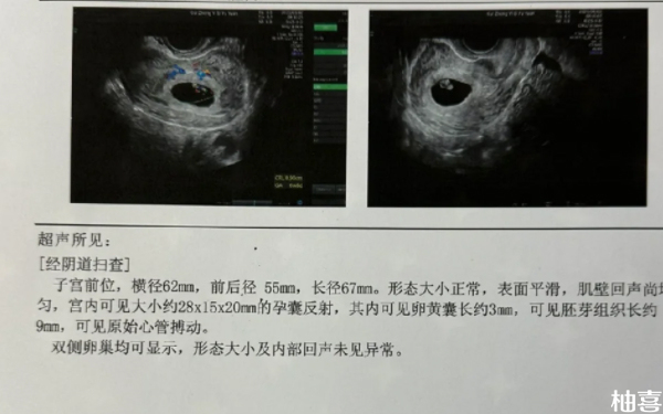 2024盛京医院冻胚移植是哪个医生？