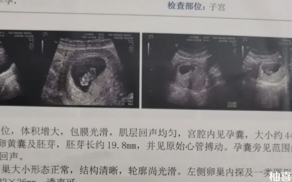 赤峰市妇产医院供精试管怀双胞胎要检查什么？