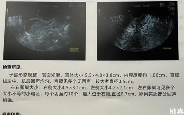 赤峰市妇产医院多囊试管多少钱？