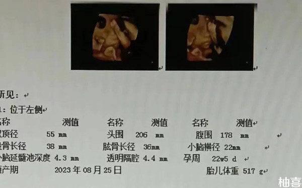 沈阳市妇婴医院试管双胞胎要住院吗？