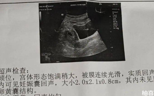 沈阳市妇婴医院试管检查流程是怎样的？