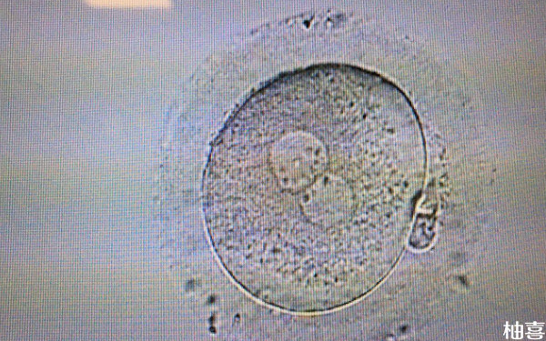 2024沈阳202医院胚胎培养多少钱？