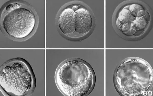 大连妇产医院囊胚移植是哪个医生做的？