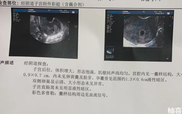 大连妇产医院生殖科一代试管转二代移植流程是什么？