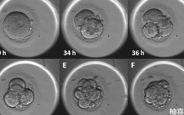 大连妇产医院试管反复移植是什么情况？