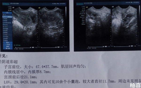 长春妇产医院鲜胚移植是哪个医生做的？