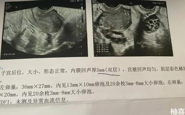 大连妇产医院多囊试管多少钱？