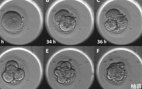 鞍山妇儿医院试管取卵后多久移植？