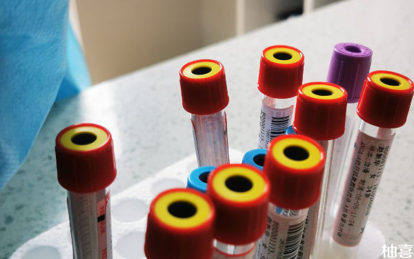 吉大二院试管进周前抽血检查必须早上去吗？