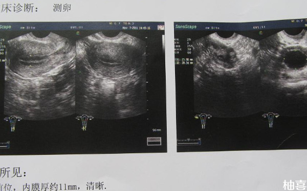 吉大一院卵泡监测需要多少钱？