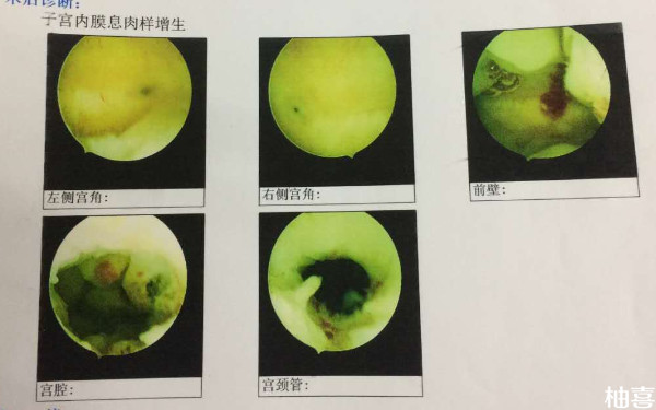 52岁没有月经能在重庆供卵做试管婴儿移植吗？