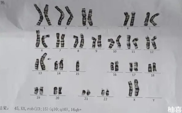 申请供卵做二代试管婴儿生的孩子是遗传供卵者的基因吗？