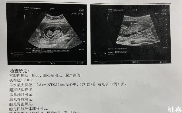 AMH值0.16申请供卵能成功怀孕吗？