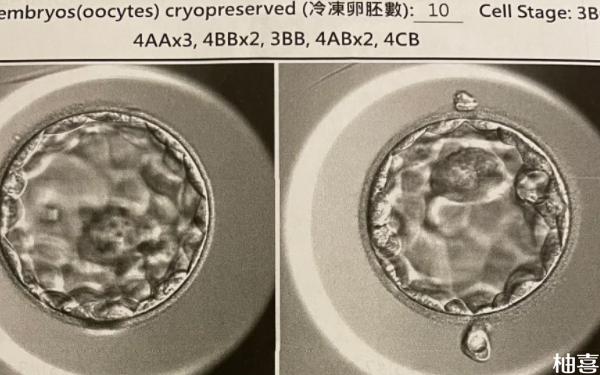 906医院生殖科囊胚移植第12天能着床了吗？