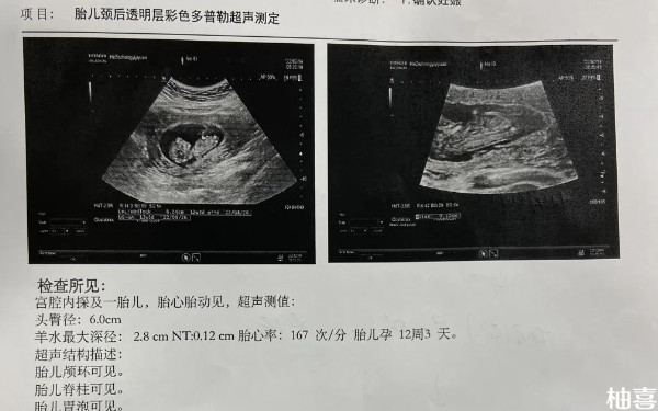 nt值1.5看男女有100%的准确率吗？