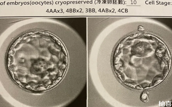 浙江台州医院生殖科移植囊胚的等级是多少好？