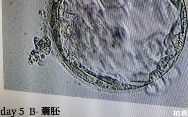 临海市台州医院生殖中心胚胎培养是按月收费吗？