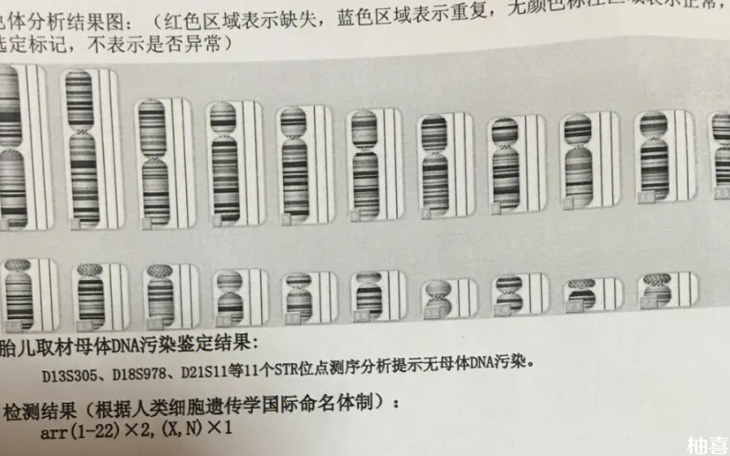 染色体鉴定准确率高