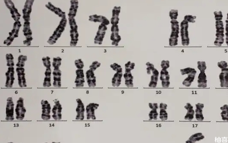 医保不能报销染色体检查费用