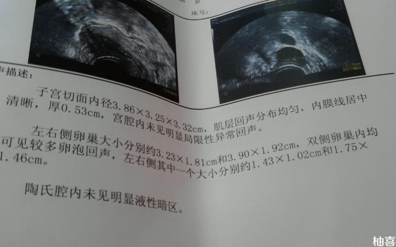 在北京做试管能报销50%-70%