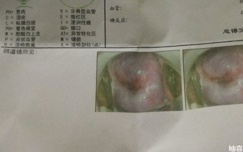 清洁度三度试管成功率在30%-40%