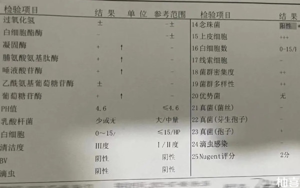 试管婴儿促排阶段什么时候做白带检查？