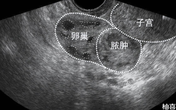 试管检查结果出来了要先给医生看还是直接建档？