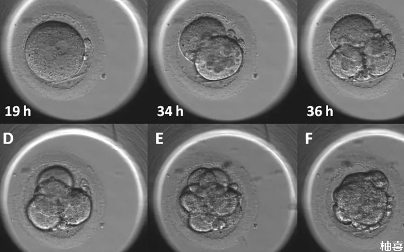 胚胎培养分为早期培养和囊胚培养