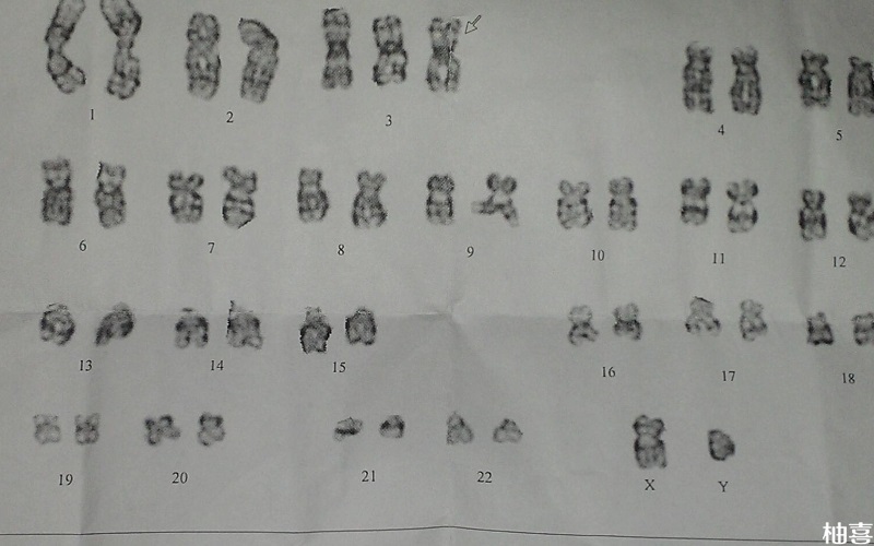 遗传因素会影响到孩子健康