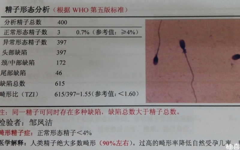 加强运动能改善精子碎片率