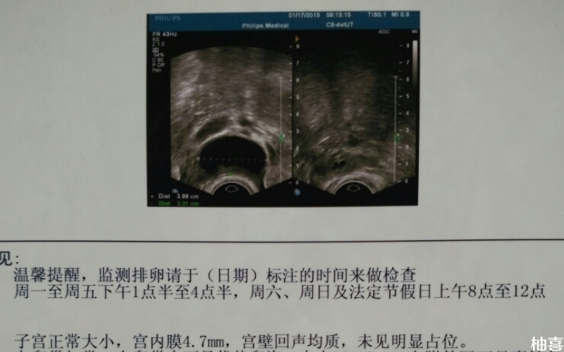 试管降调成功内膜不会增厚