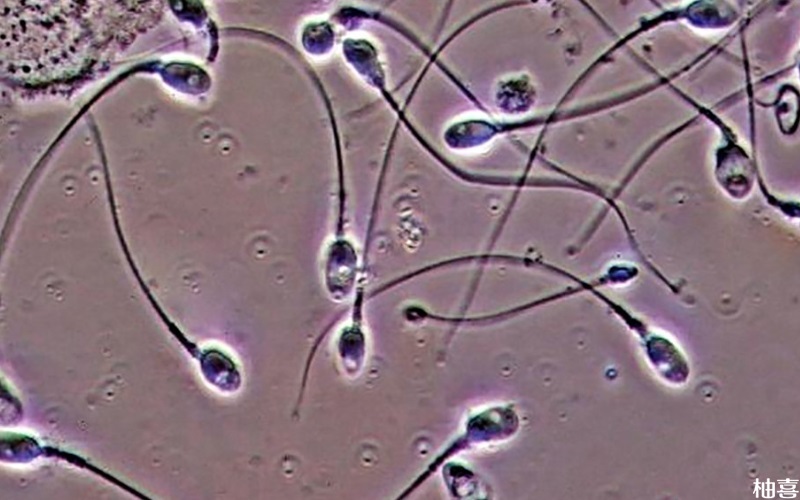 穿刺取精针对梗阻性无精子症