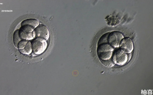 5天囊胚移植前要做白带检查吗？