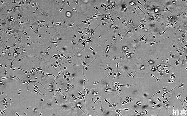 精子dna碎片率高可以人工挑出健康的精子吗？