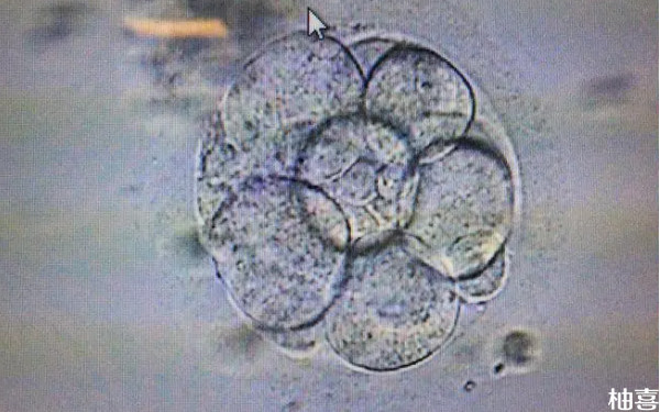 5天囊胚移植第10天雌二醇599正常吗？