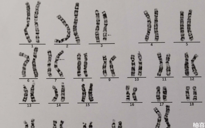 染色体微阵列分析用来筛查染色体疾病
