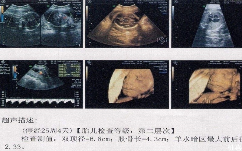 建档时间晚了一周没有关系